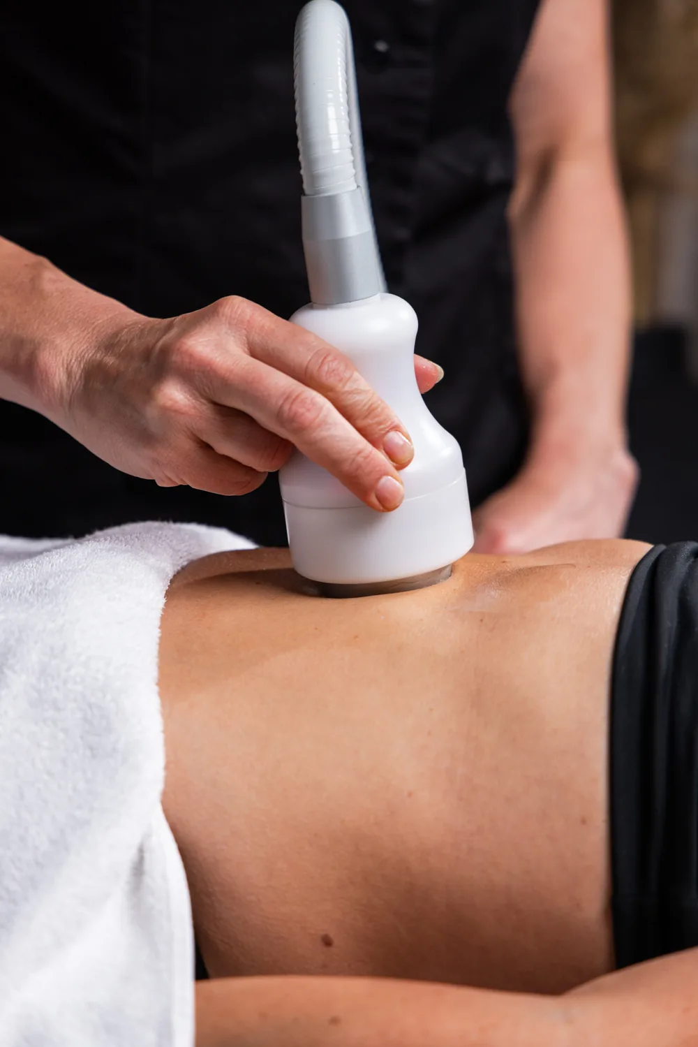 Cryo T-Shock-handstycke på magen under behandling